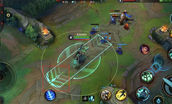 英雄联盟锤石出装推荐