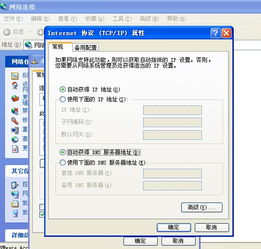 电脑怎样释放IP地址？