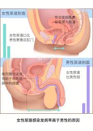 女生喊痛男生却继续深入的原因探究