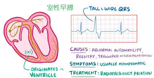 POP心跳链接是什么?