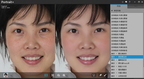 沈玉琳眼部状况